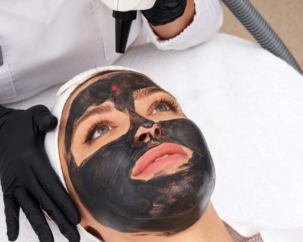 carbon laser facial altrincham