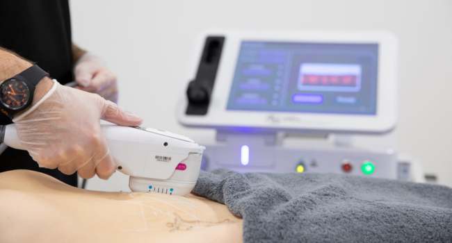 3d hifu treatments face body