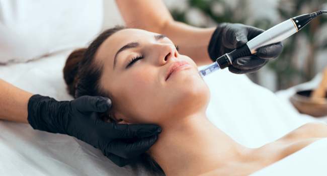 microneedling treatments