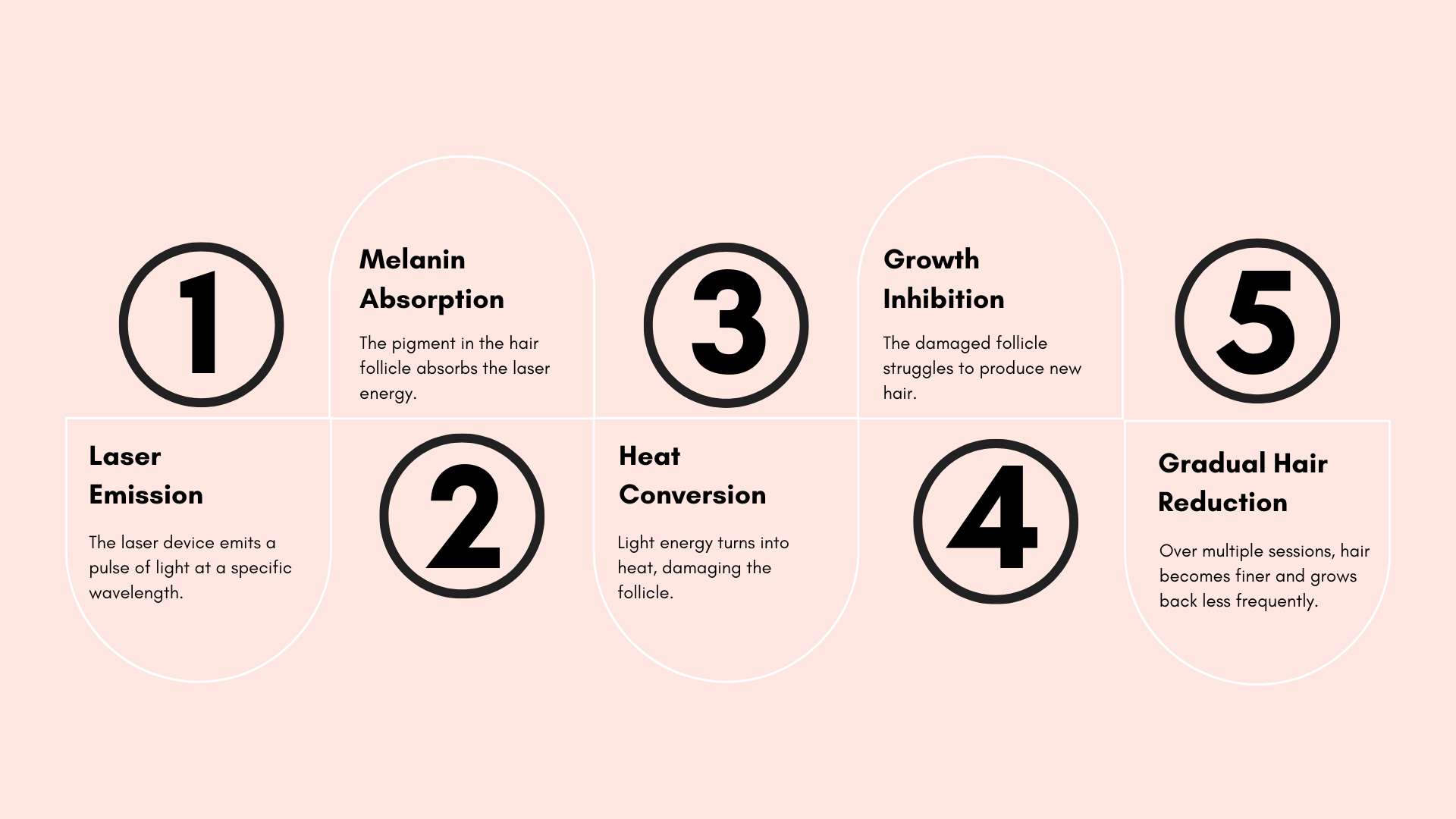 laser hair removal stages